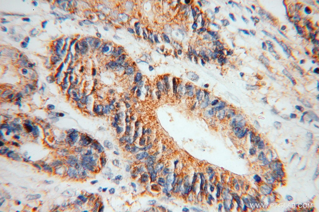 CKB/CKM Polyclonal antibody