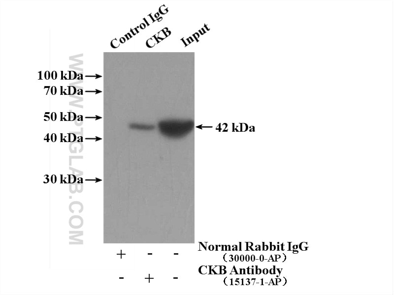Immunoprecipitation (IP) experiment of mouse brain tissue using CKB/CKM Polyclonal antibody (15137-1-AP)