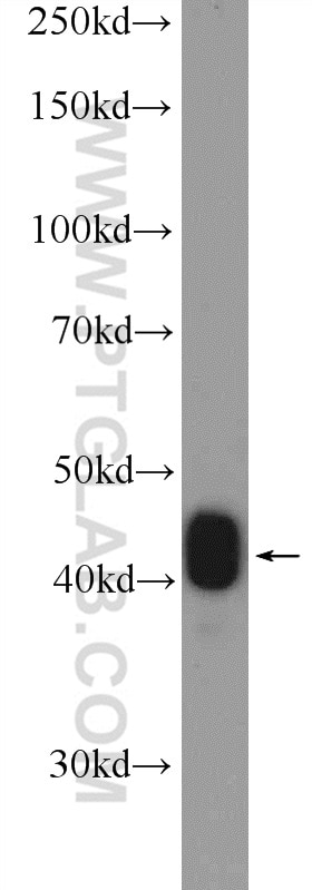 WB analysis of mouse colon using 15137-1-AP