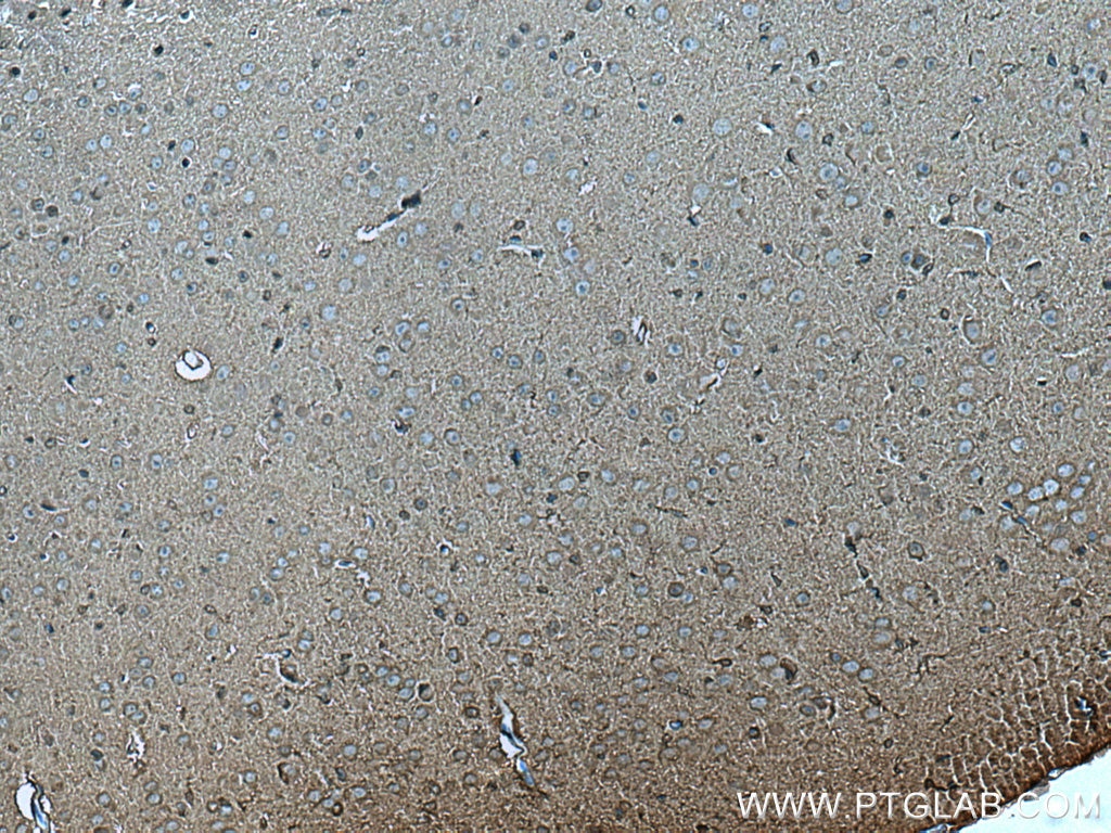 Immunohistochemistry (IHC) staining of mouse brain tissue using CKB Monoclonal antibody (66764-1-Ig)