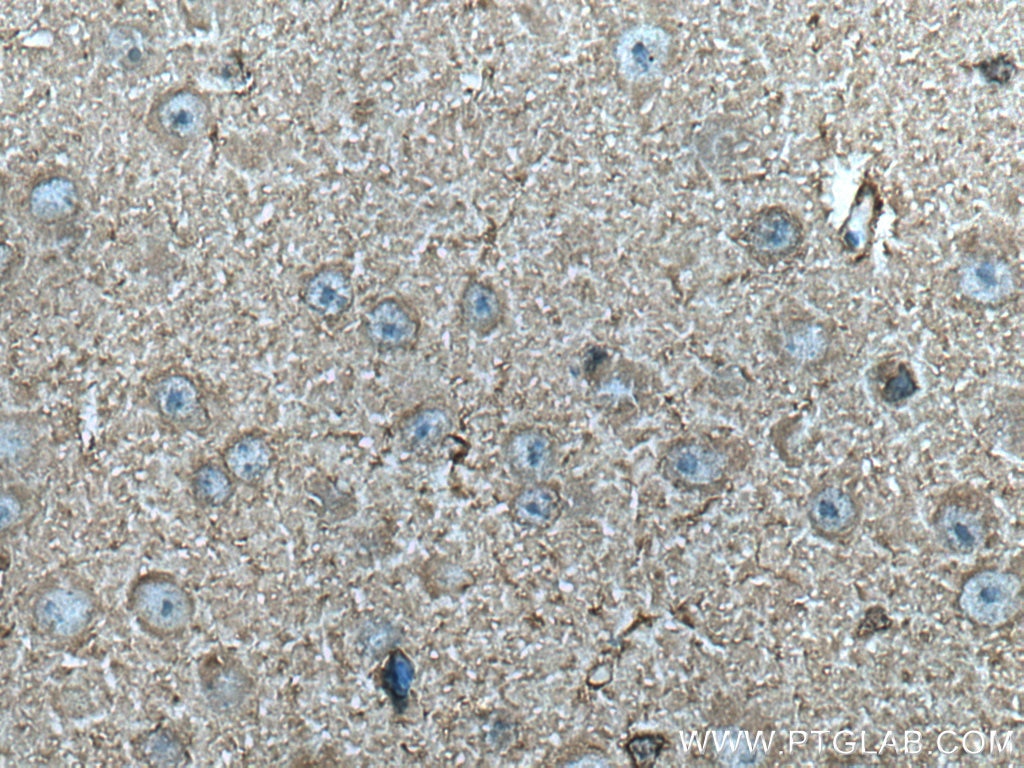 Immunohistochemistry (IHC) staining of mouse brain tissue using CKB Monoclonal antibody (66764-1-Ig)