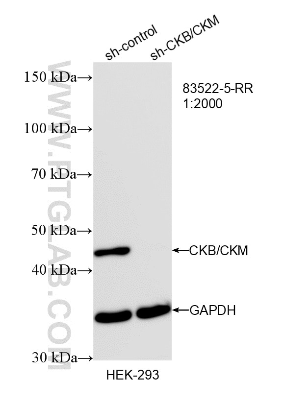 Western Blot (WB) analysis of HEK-293 cells using CKB-Specific Recombinant monoclonal antibody (83522-5-RR)