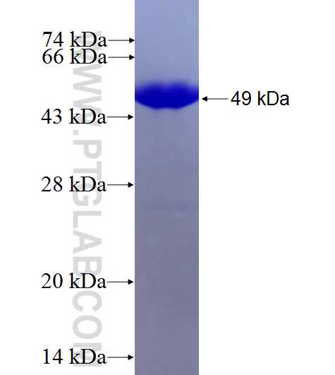 CKB fusion protein Ag7933 SDS-PAGE