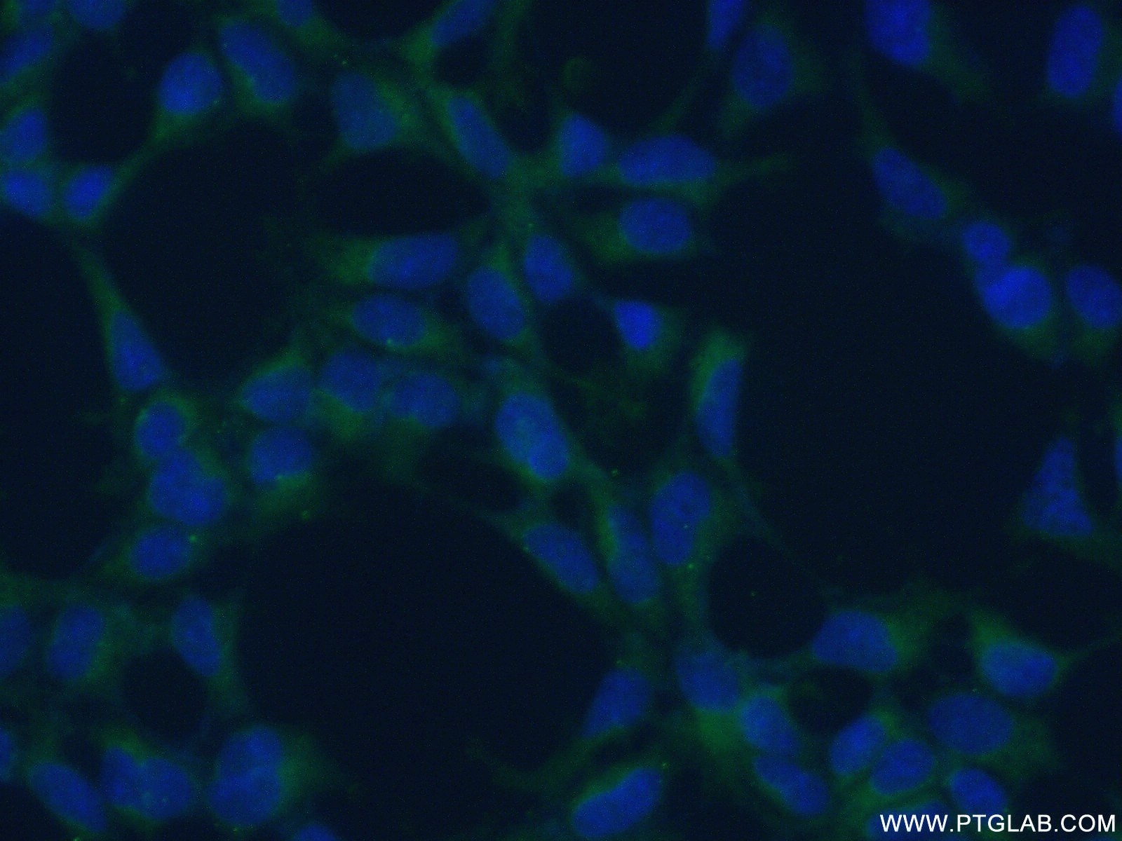 Immunofluorescence (IF) / fluorescent staining of HEK-293 cells using CKB-Specific Polyclonal antibody (18713-1-AP)
