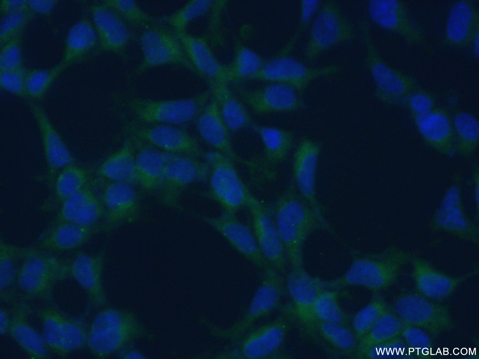 IF Staining of HEK-293 using 18713-1-AP