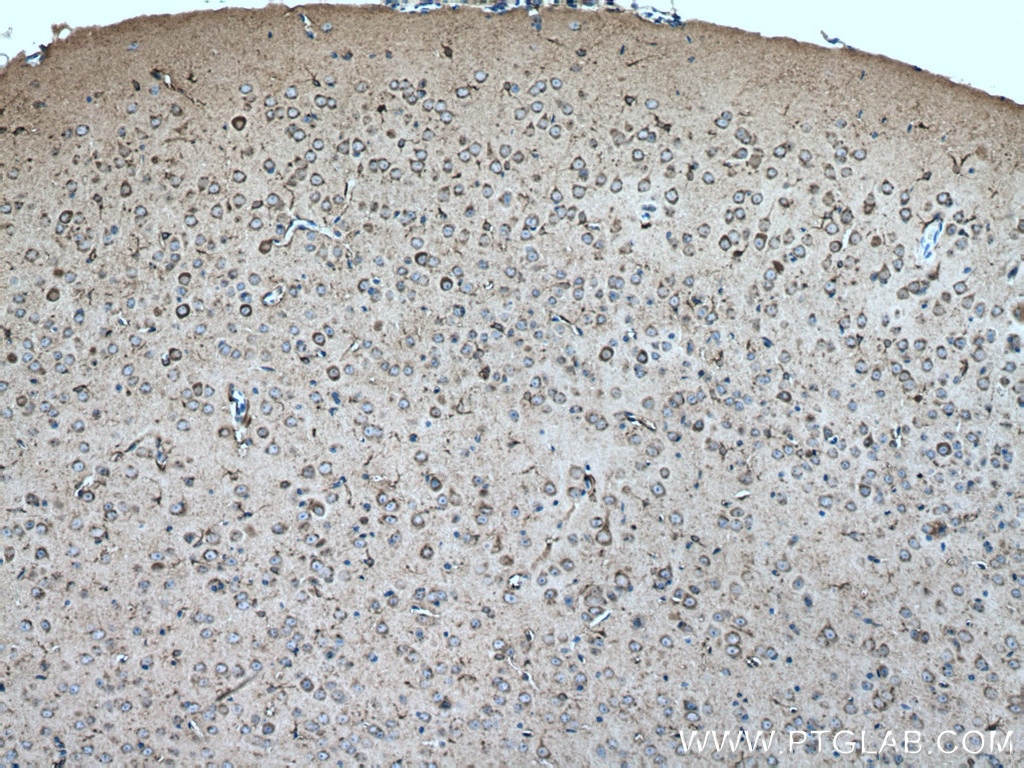 Immunohistochemistry (IHC) staining of mouse brain tissue using CKB-Specific Polyclonal antibody (18713-1-AP)