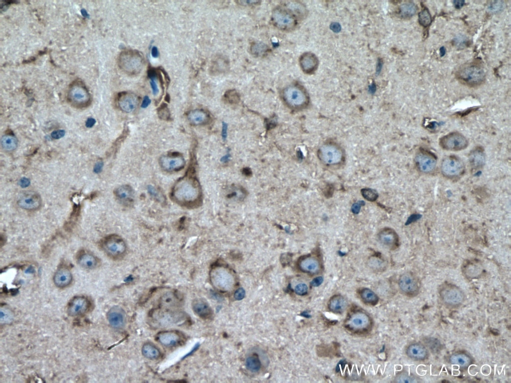 Immunohistochemistry (IHC) staining of mouse brain tissue using CKB-Specific Polyclonal antibody (18713-1-AP)