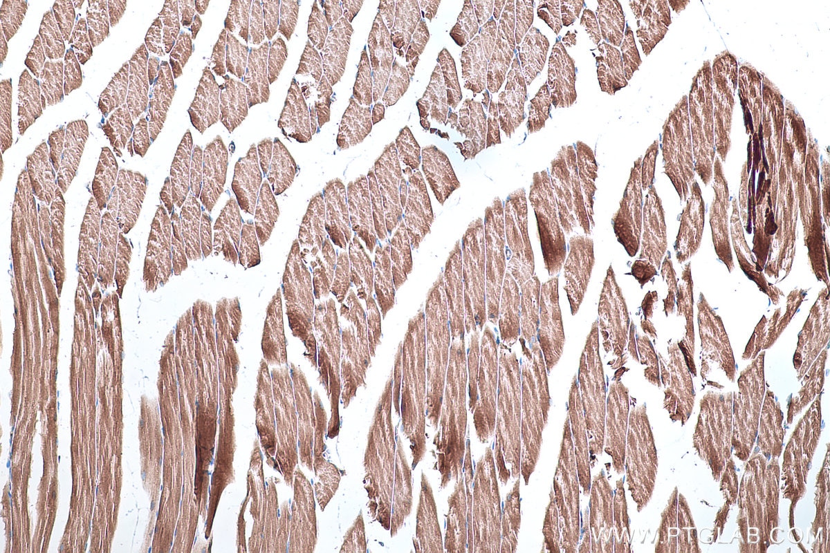 Immunohistochemistry (IHC) staining of mouse skeletal muscle tissue using CKB-Specific Polyclonal antibody (18713-1-AP)