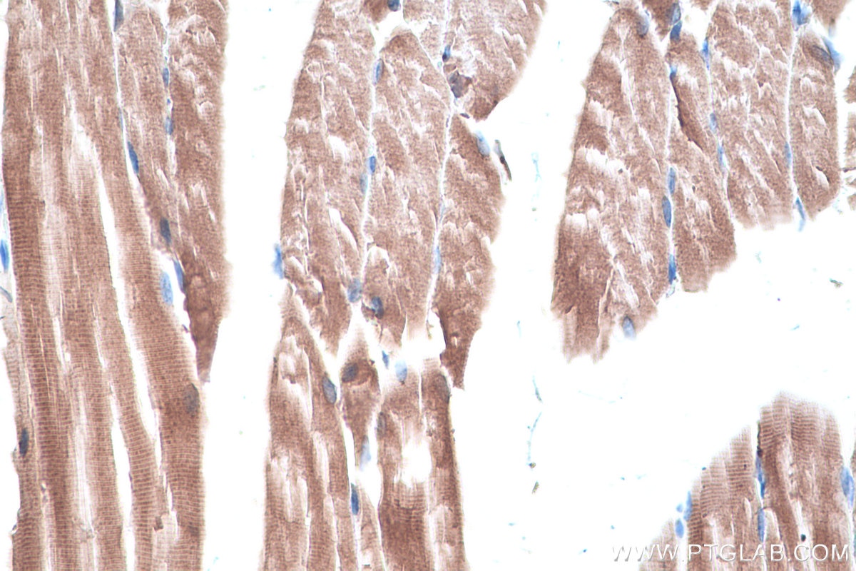 Immunohistochemistry (IHC) staining of mouse skeletal muscle tissue using CKB-Specific Polyclonal antibody (18713-1-AP)