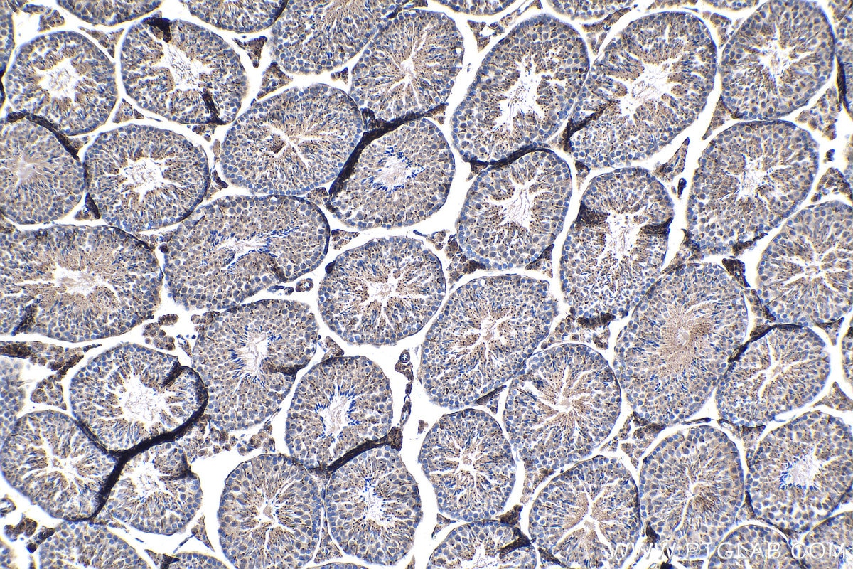Immunohistochemistry (IHC) staining of mouse testis tissue using CKB-Specific Polyclonal antibody (18713-1-AP)