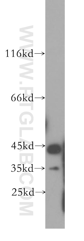 Western Blot (WB) analysis of mouse colon tissue using CKB-Specific Polyclonal antibody (18713-1-AP)