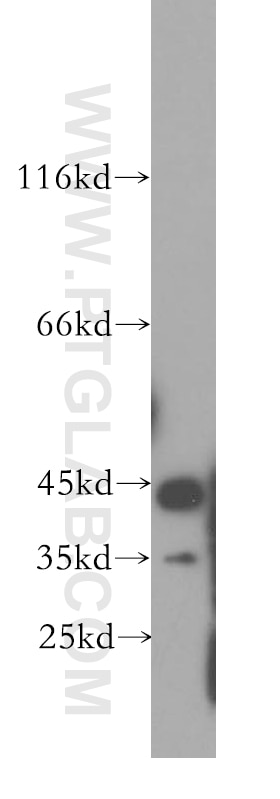 WB analysis of mouse colon using 18713-1-AP