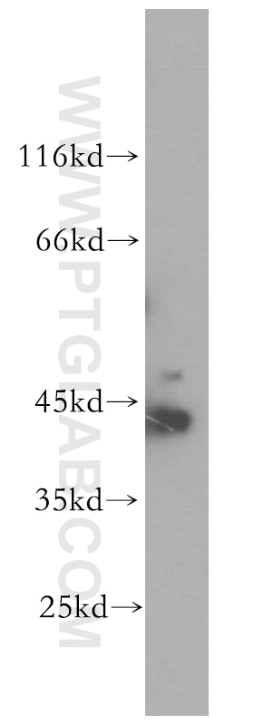 Western Blot (WB) analysis of HEK-293 cells using CKB-Specific Polyclonal antibody (18713-1-AP)