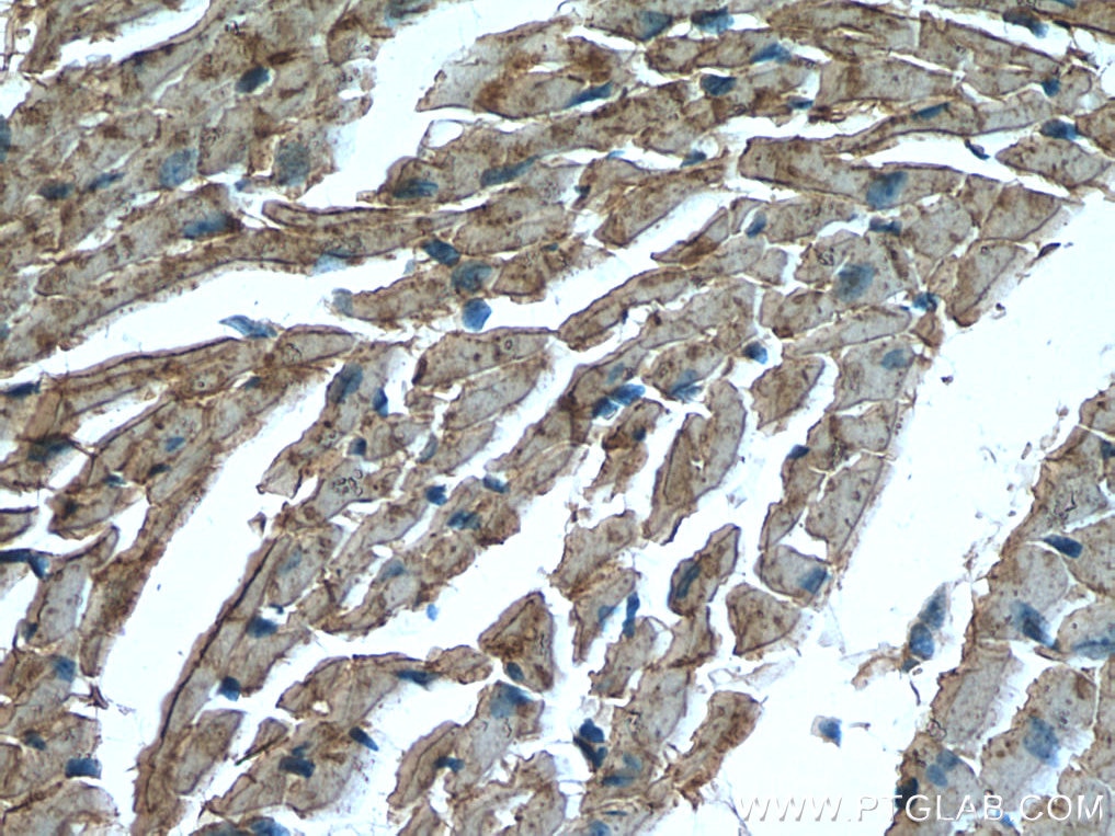 Immunohistochemistry (IHC) staining of mouse heart tissue using CKM/CKB Polyclonal antibody (15891-1-AP)
