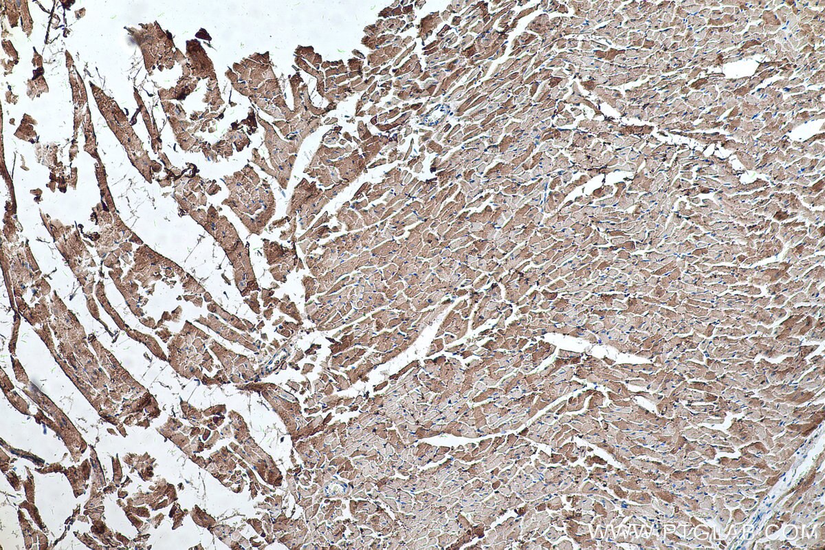 Immunohistochemistry (IHC) staining of rat heart tissue using CKM/CKB Polyclonal antibody (15891-1-AP)