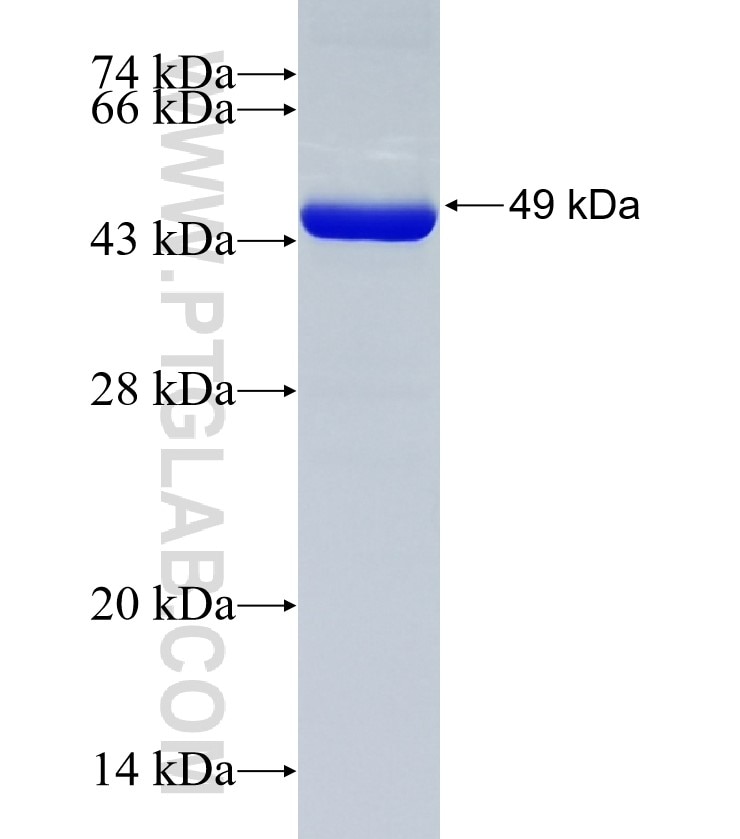 CKM fusion protein Ag8557 SDS-PAGE