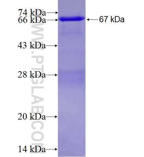 CKM fusion protein Ag8678 SDS-PAGE