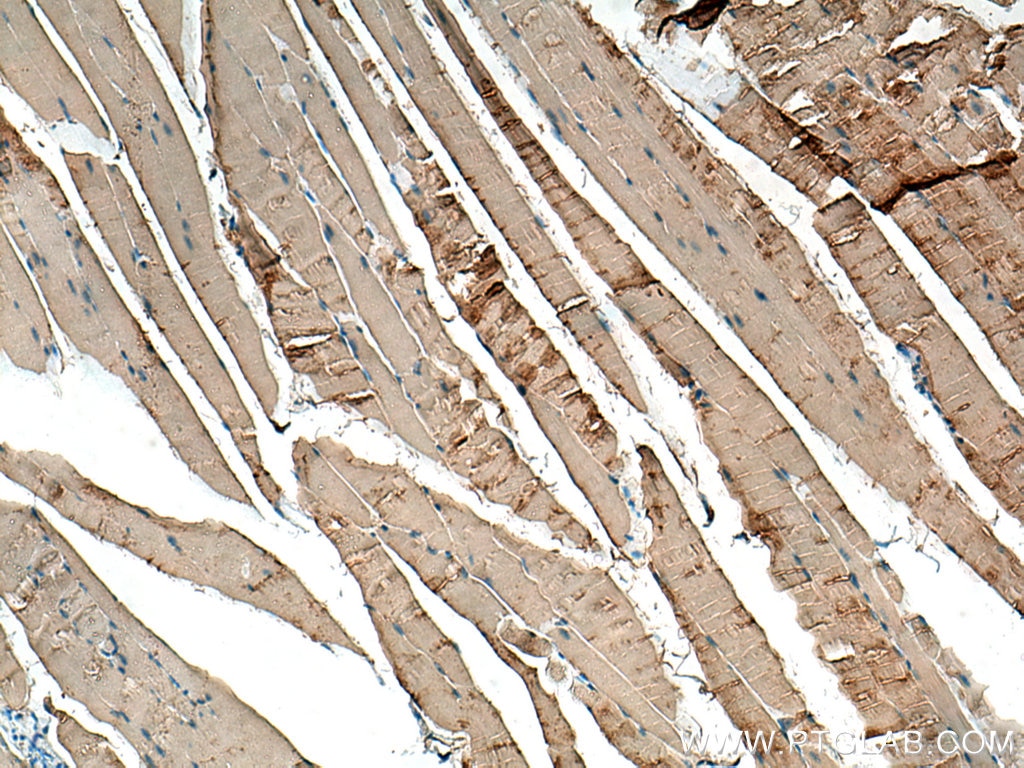 Immunohistochemistry (IHC) staining of mouse skeletal muscle tissue using CKM-Specific Polyclonal antibody (18712-1-AP)