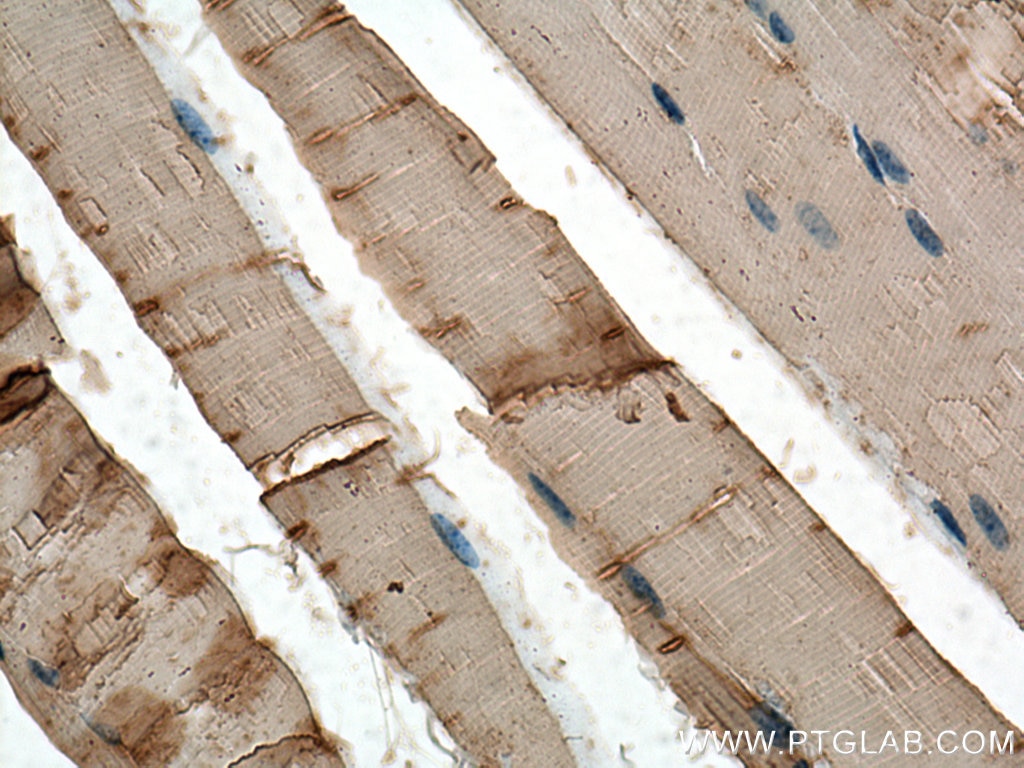 Immunohistochemistry (IHC) staining of mouse skeletal muscle tissue using CKM-Specific Polyclonal antibody (18712-1-AP)