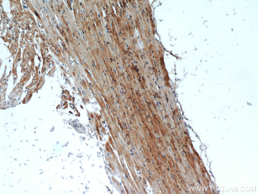 Immunohistochemistry (IHC) staining of rat heart tissue using CKM-Specific Polyclonal antibody (18712-1-AP)