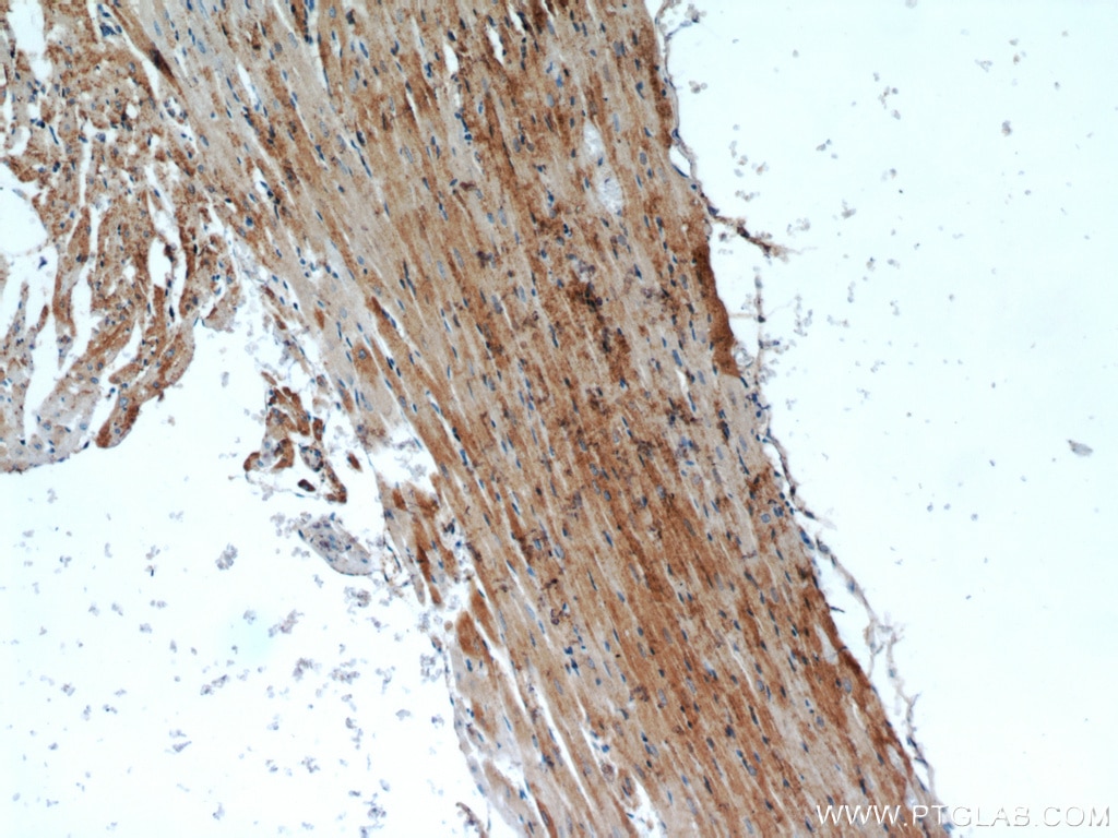 IHC staining of rat heart using 18712-1-AP