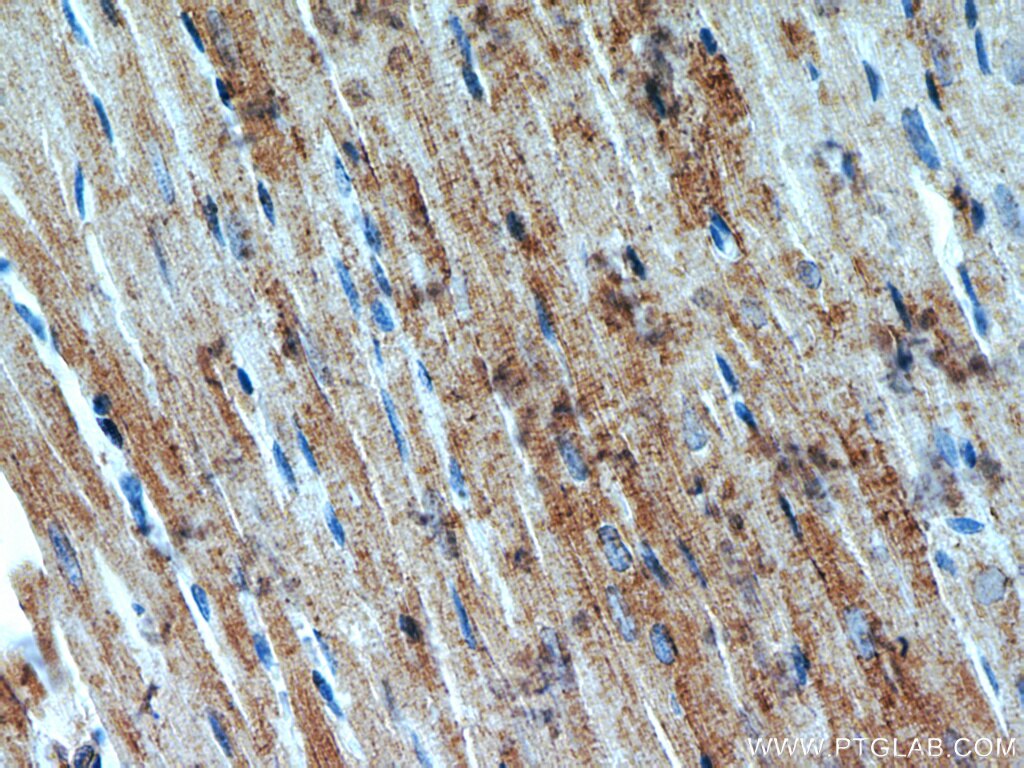 Immunohistochemistry (IHC) staining of rat heart tissue using CKM-Specific Polyclonal antibody (18712-1-AP)