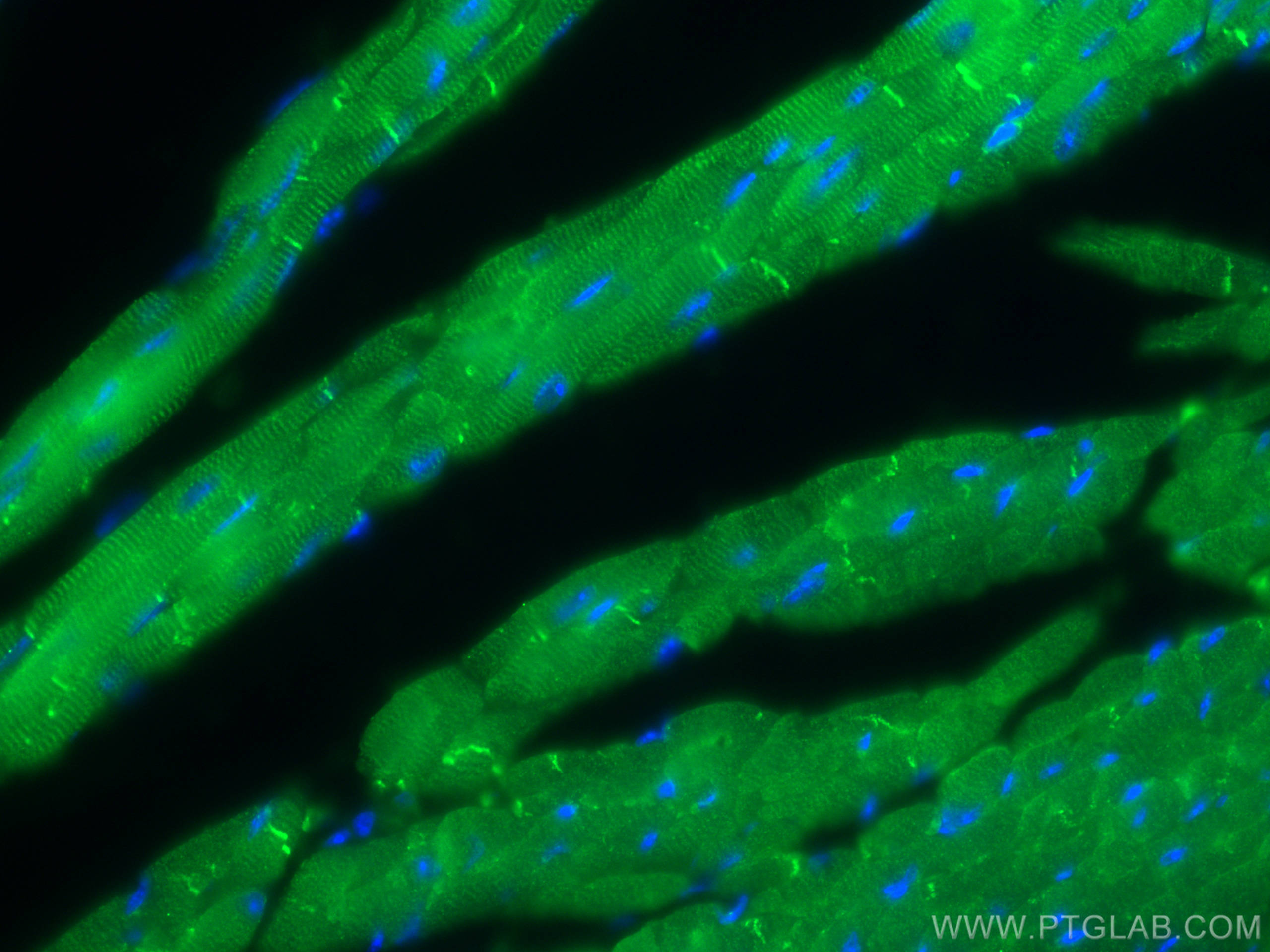 Immunofluorescence (IF) / fluorescent staining of mouse heart tissue using CKM-Specific Monoclonal antibody (60177-1-Ig)