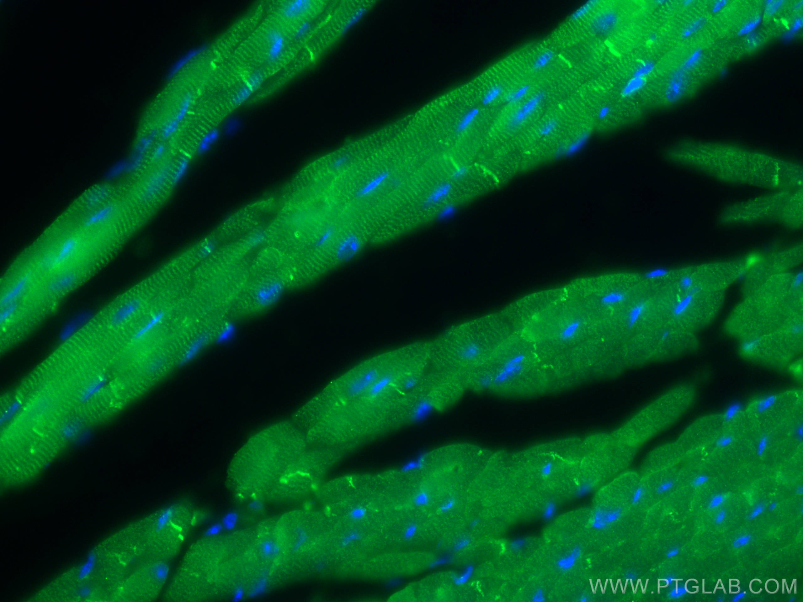 IF Staining of mouse heart using 60177-1-Ig