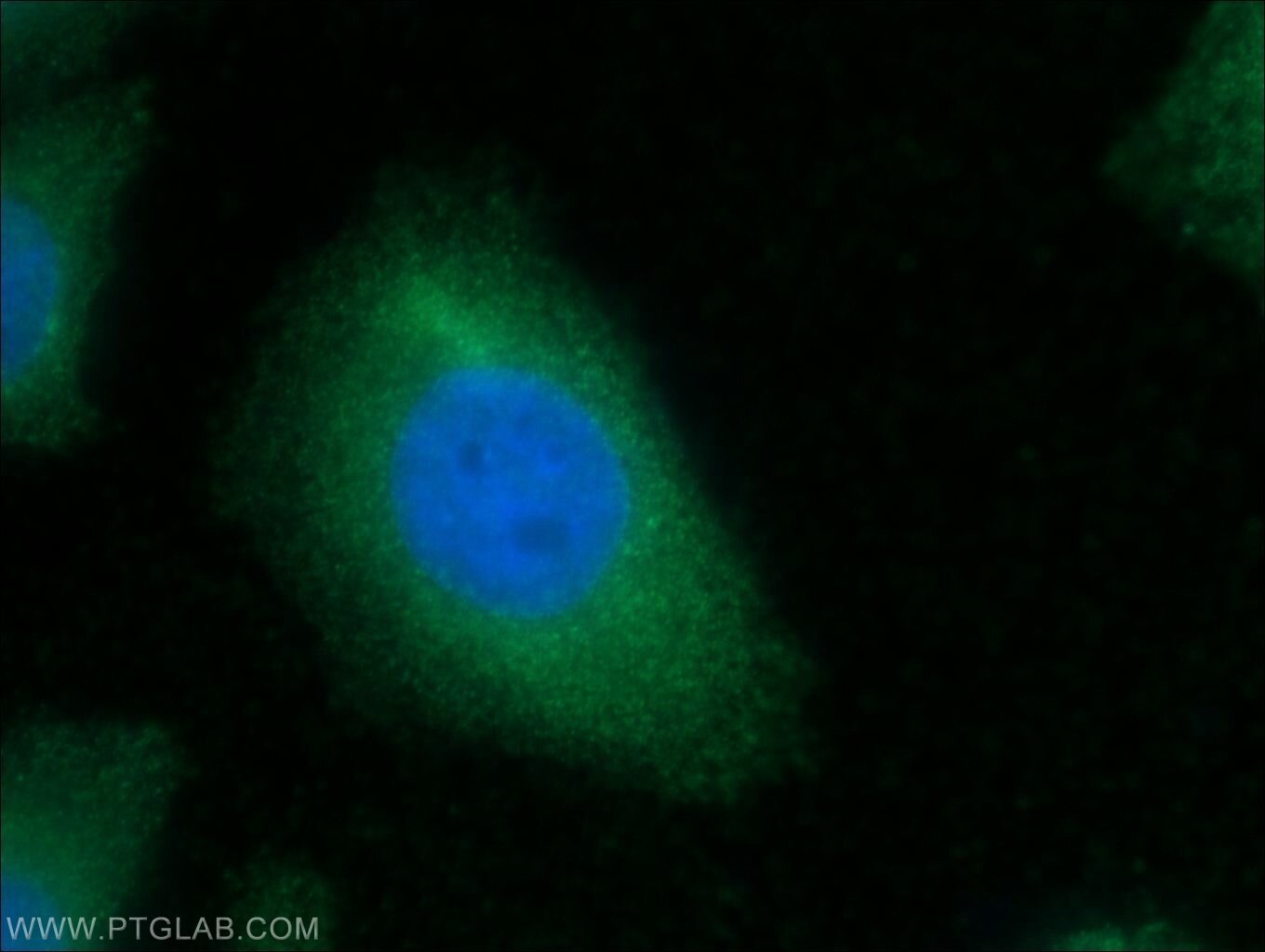 Immunofluorescence (IF) / fluorescent staining of HepG2 cells using CKM-Specific Monoclonal antibody (60177-1-Ig)