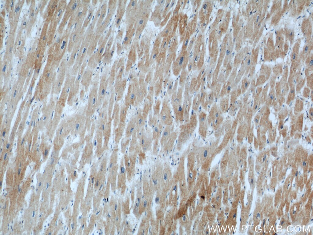 Immunohistochemistry (IHC) staining of human heart tissue using CKM-Specific Monoclonal antibody (60177-1-Ig)