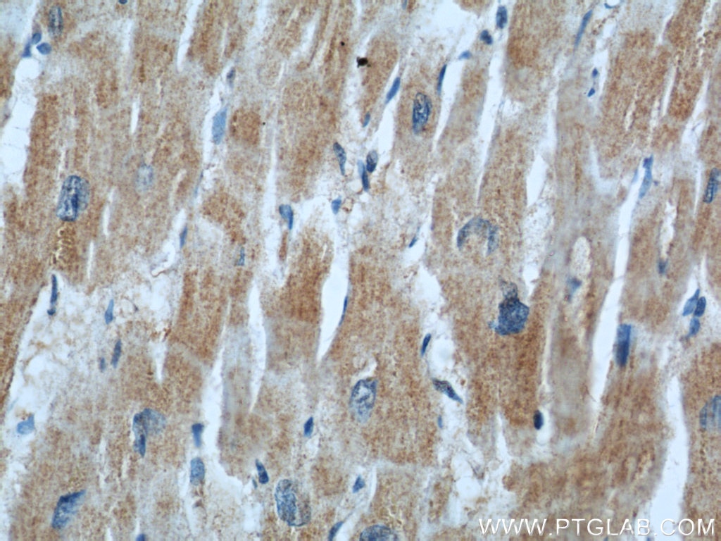 Immunohistochemistry (IHC) staining of human heart tissue using CKM-Specific Monoclonal antibody (60177-1-Ig)