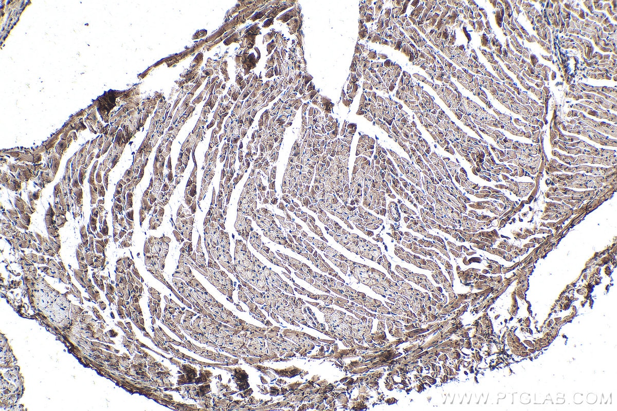 Immunohistochemistry (IHC) staining of mouse heart tissue using CKM-Specific Monoclonal antibody (60177-1-Ig)