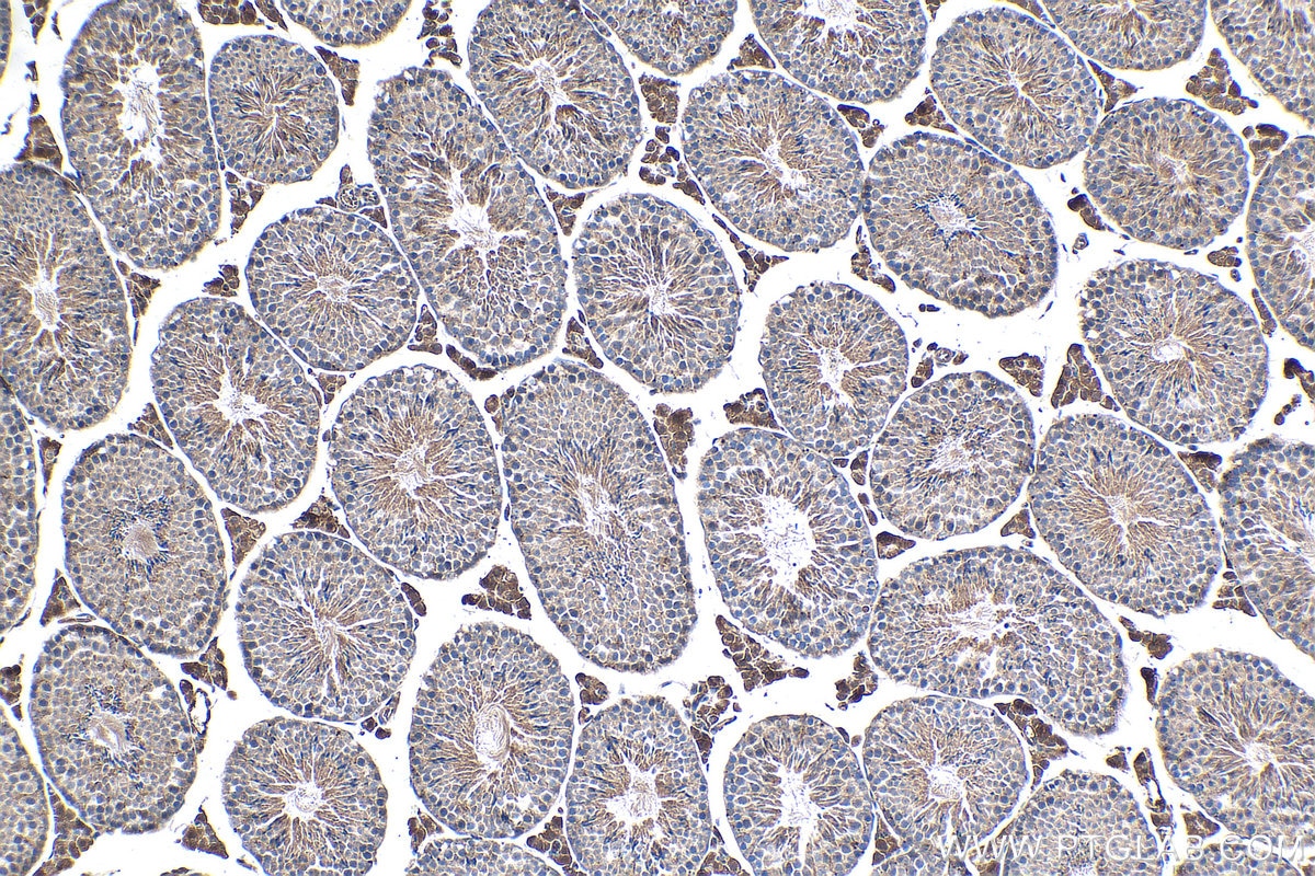 IHC staining of mouse testis using 60177-1-Ig