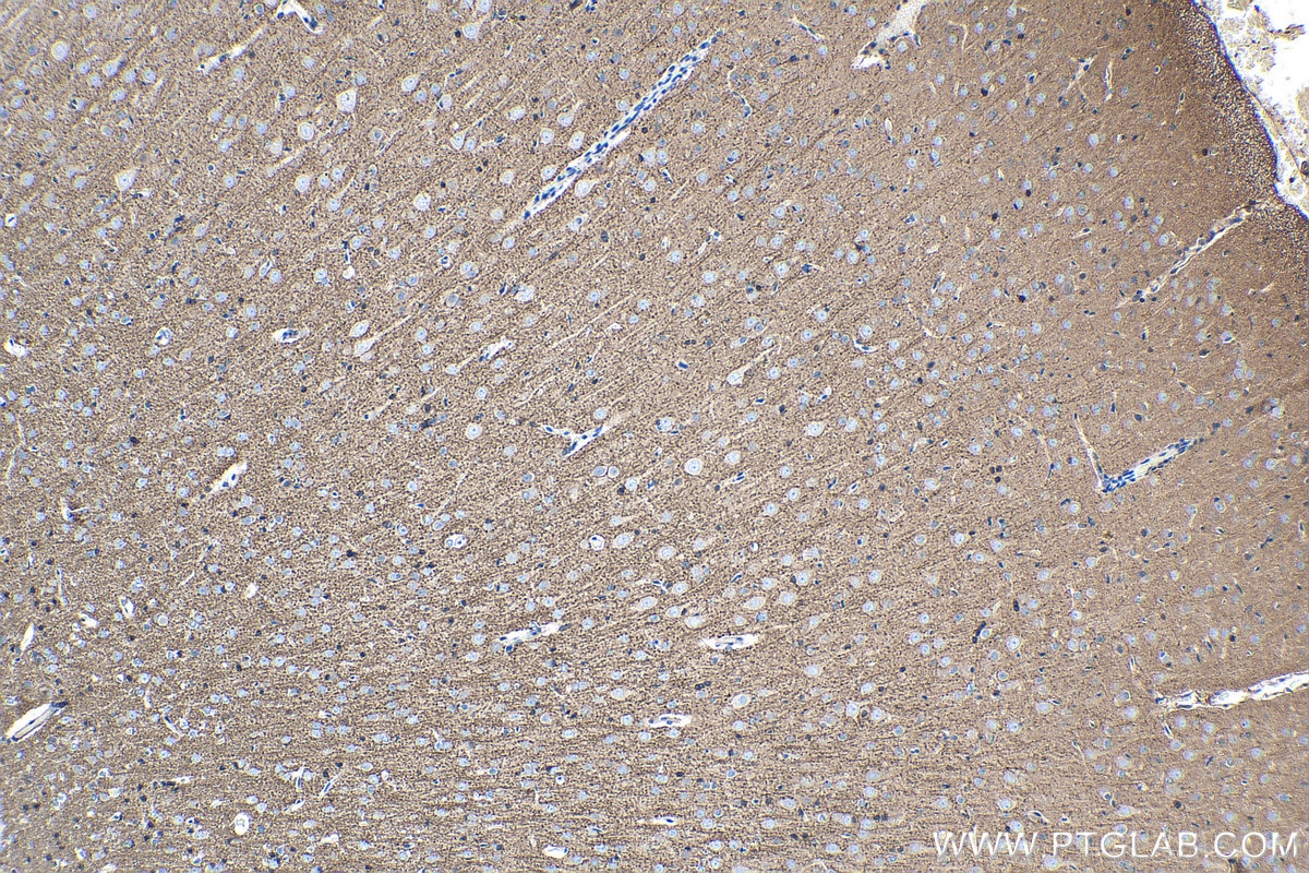 Immunohistochemistry (IHC) staining of rat brain tissue using CKM-Specific Monoclonal antibody (60177-1-Ig)