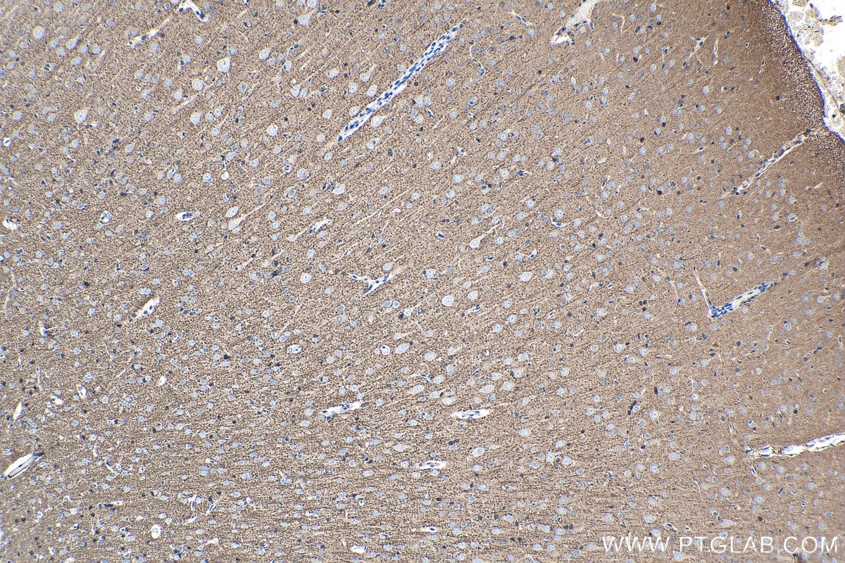 Immunohistochemistry (IHC) staining of rat brain tissue using CKM-Specific Monoclonal antibody (60177-1-Ig)