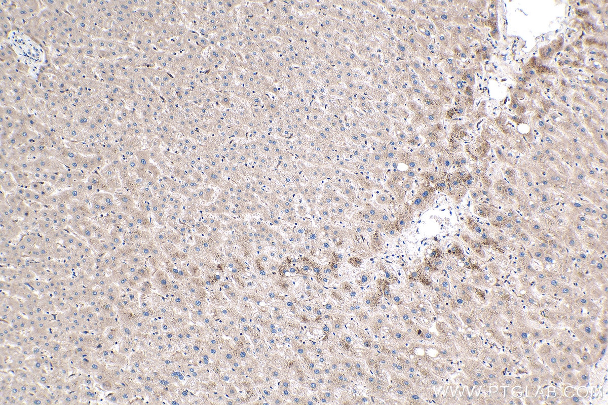 Immunohistochemistry (IHC) staining of human liver tissue using CKM-Specific Monoclonal antibody (60177-1-Ig)
