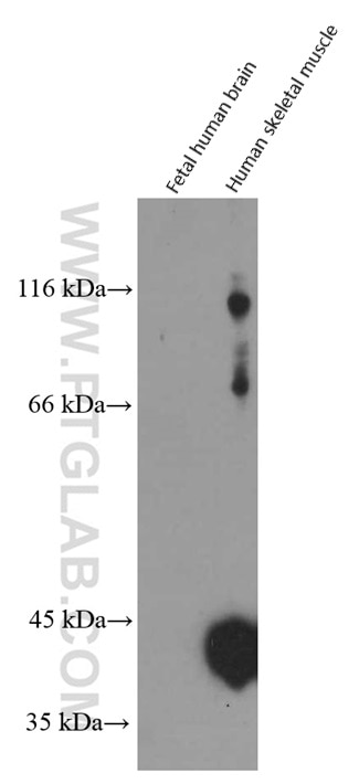 Western Blot (WB) analysis of human skeletal muscle tissue using CKM-Specific Monoclonal antibody (60177-1-Ig)