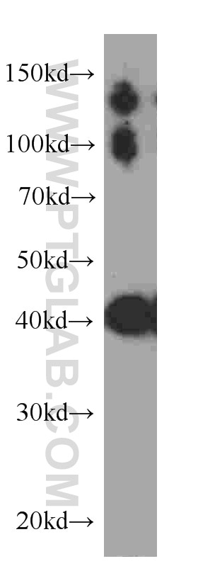 Western Blot (WB) analysis of human skeletal muscle tissue using CKM-Specific Monoclonal antibody (60177-1-Ig)