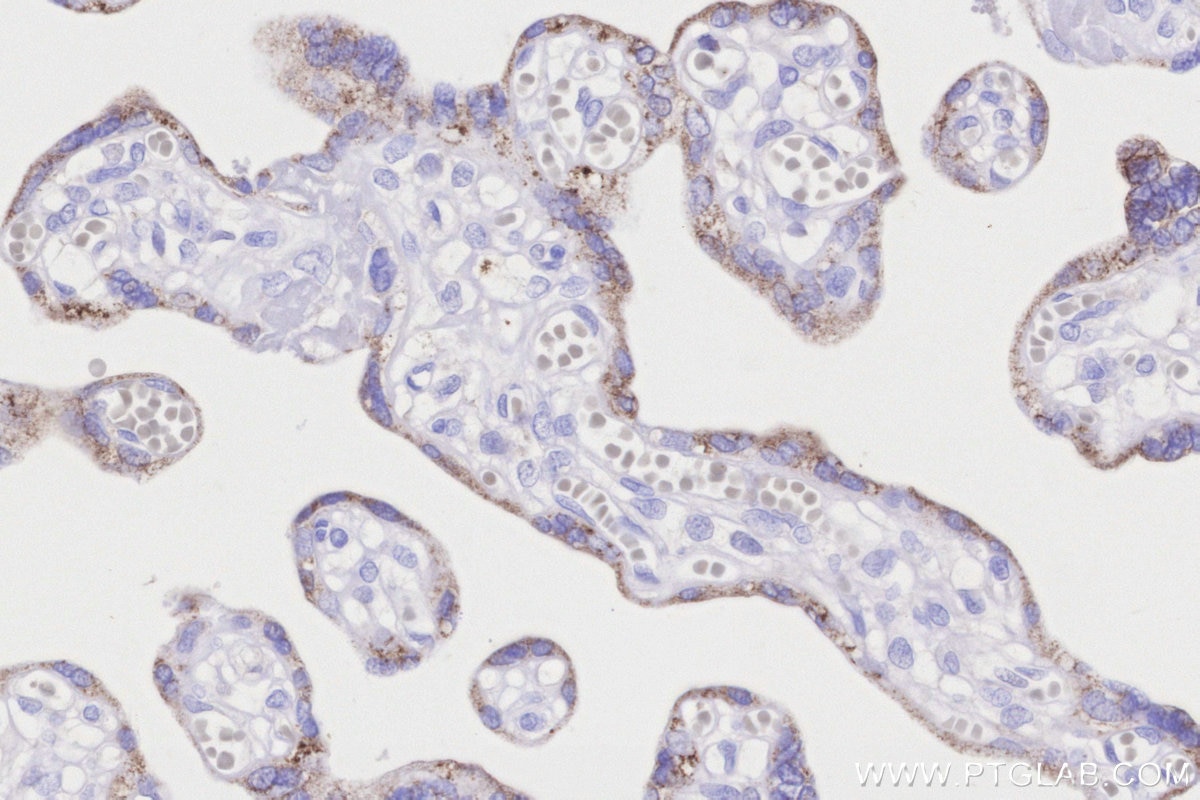 Immunohistochemistry (IHC) staining of human placenta tissue using CKMT1A Polyclonal antibody (15346-1-AP)