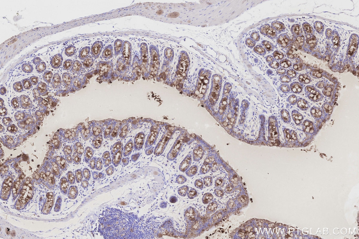 Immunohistochemistry (IHC) staining of mouse colon tissue using CKMT1A Polyclonal antibody (15346-1-AP)