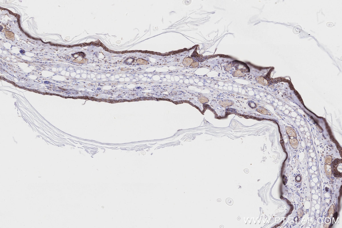 Immunohistochemistry (IHC) staining of rat skin tissue using CKMT1A Polyclonal antibody (15346-1-AP)