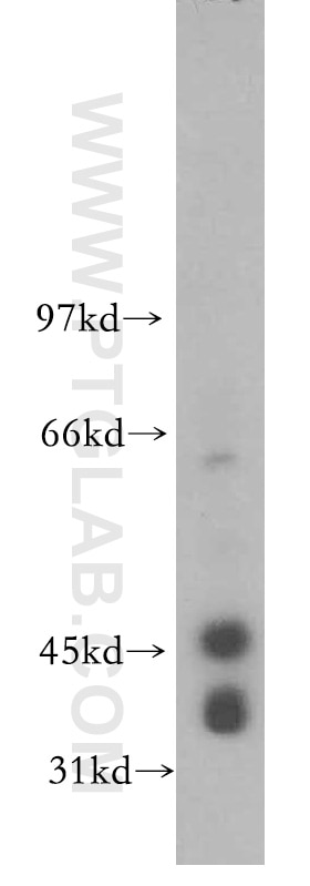 Western Blot (WB) analysis of human colon tissue using CKMT1A Polyclonal antibody (15346-1-AP)