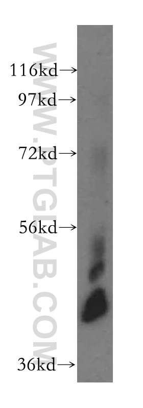Western Blot (WB) analysis of human testis tissue using CKMT1A Polyclonal antibody (15346-1-AP)