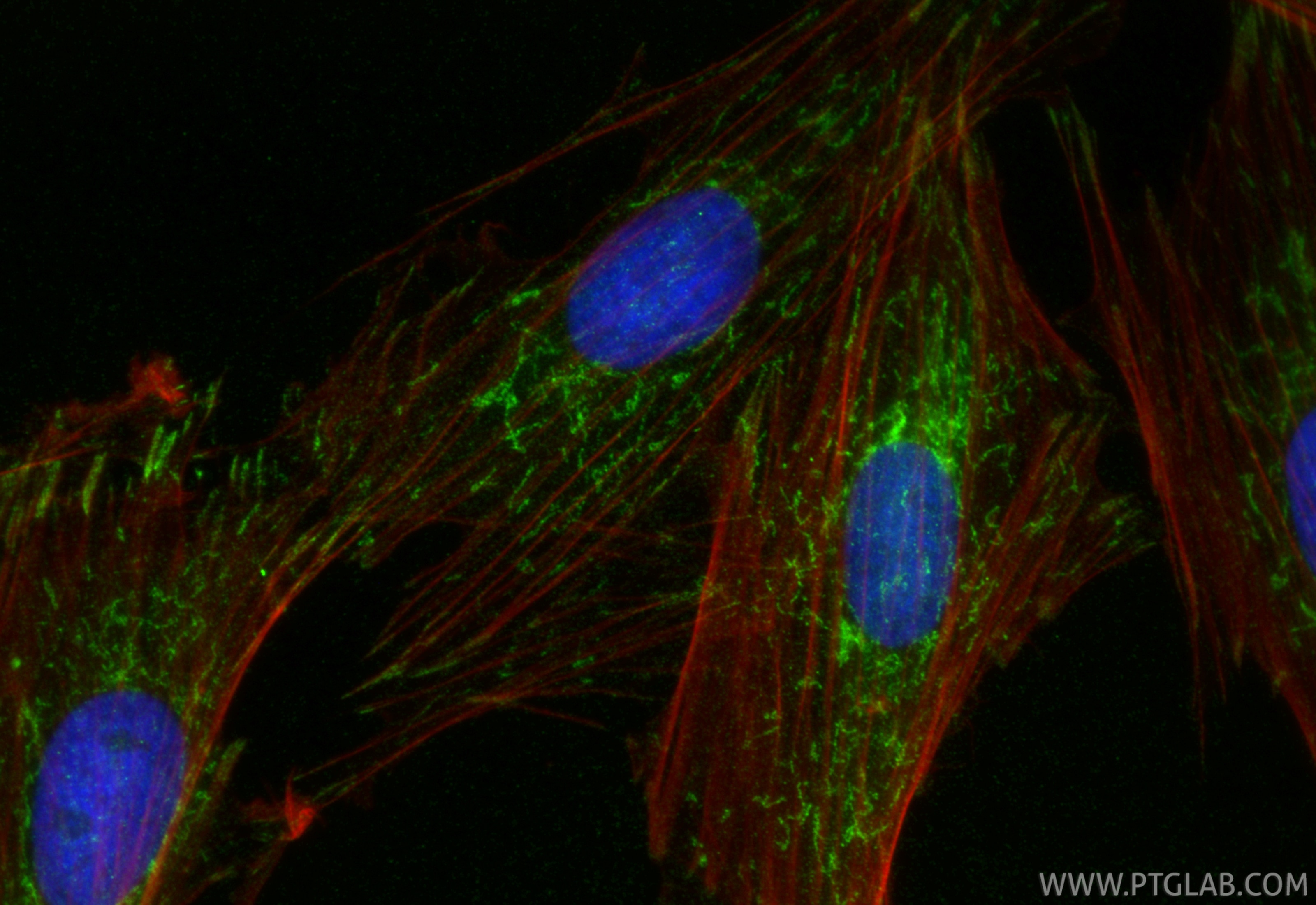 Immunofluorescent analysis of (4% PFA) fixed H9C2 cells using CKMT2 antibody (13207-1-AP) at dilution of 1:400 and CoraLite®488-Conjugated Goat Anti-Rabbit IgG(H+L) (SA00013-2), CL594-phalloidin (red). Immunofluorescence (IF) / fluorescent staining of H9C2 cells using CKMT2 Polyclonal antibody (13207-1-AP)