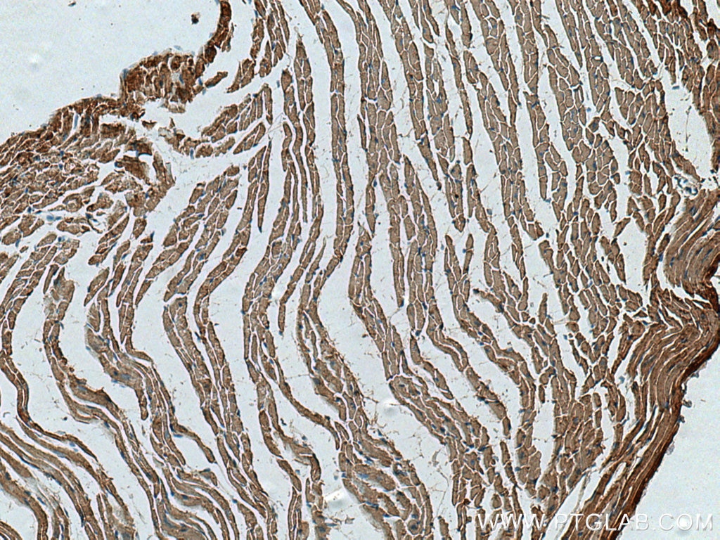 Immunohistochemistry (IHC) staining of mouse heart tissue using CKMT2 Polyclonal antibody (13207-1-AP)