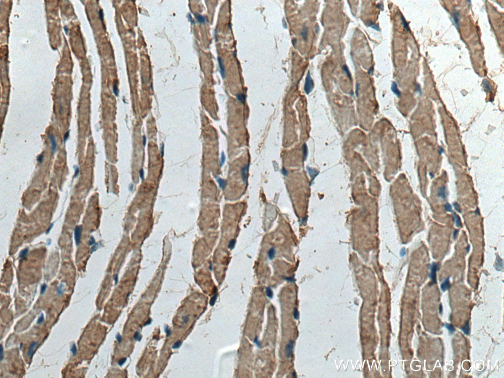 Immunohistochemistry (IHC) staining of mouse heart tissue using CKMT2 Polyclonal antibody (13207-1-AP)