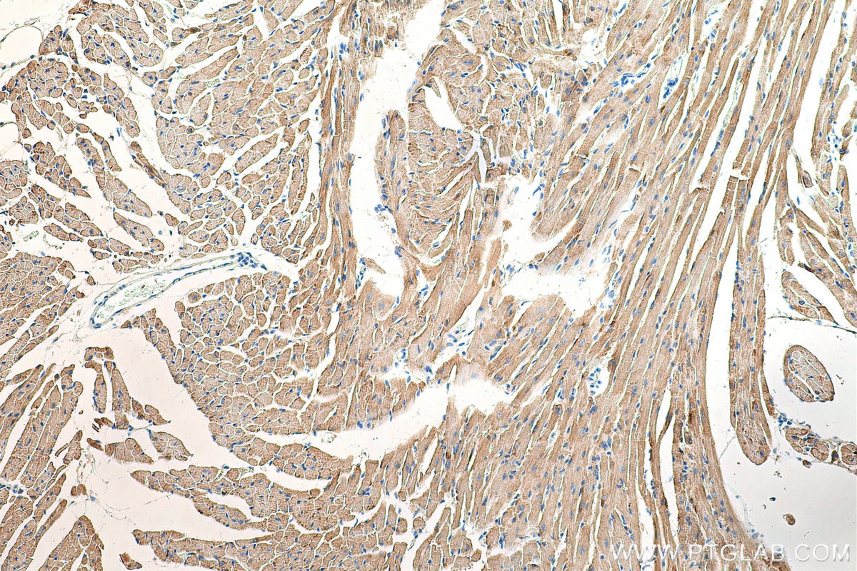 Immunohistochemistry (IHC) staining of mouse heart tissue using CKMT2 Polyclonal antibody (13207-1-AP)