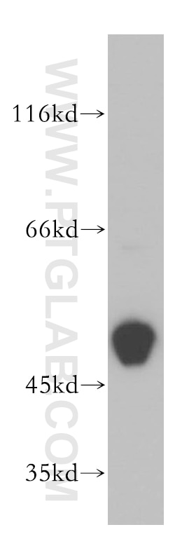 Western Blot (WB) analysis of human skeletal muscle tissue using CKMT2 Polyclonal antibody (13207-1-AP)