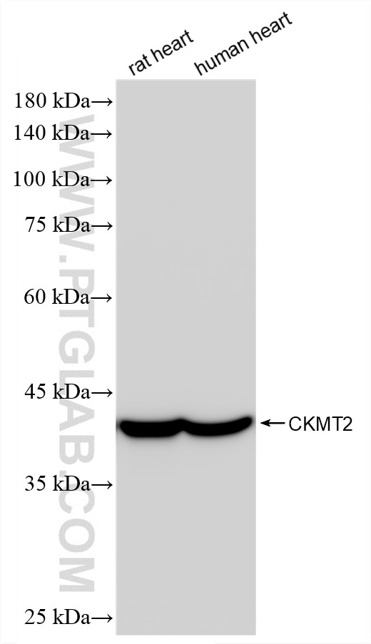 WB analysis using 87517-1-RR Western Blot (WB) analysis of various lysates using CKMT2 Recombinant monoclonal antibody (87517-1-RR)
