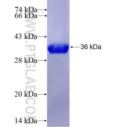 CKS1B fusion protein Ag0928 SDS-PAGE